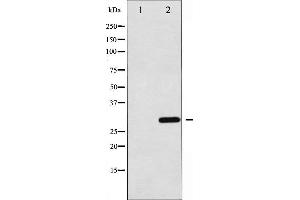 Western blot analysis of C/EBP-alpha expression in 293 whole cell lysates,The lane on the left is treated with the antigen-specific peptide. (CEBPA antibody  (N-Term))
