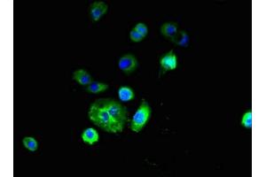 Immunofluorescent analysis of A431 cells using ABIN7151164 at dilution of 1:100 and Alexa Fluor 488-congugated AffiniPure Goat Anti-Rabbit IgG(H+L) (RNF182 antibody  (AA 1-160))
