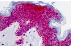Human Skin: Formalin-Fixed, Paraffin-Embedded (FFPE) (Syndecan 1 antibody)