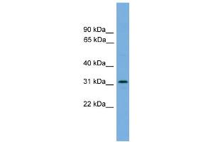 WB Suggested Anti-DAPP1 Antibody Titration: 0. (DAPP1 antibody  (Middle Region))