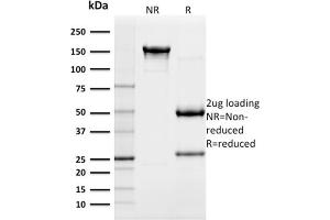 SDS-PAGE Analysis Purified CD117 Mouse Monoclonal Antibody (KIT/982). (KIT antibody  (AA 100-300))