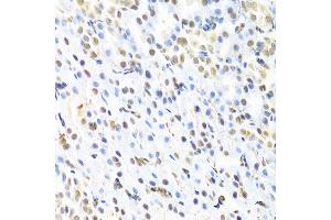 Immunohistochemistry (IHC) image for anti-Runt-Related Transcription Factor 1 (RUNX1) (AA 150-250) antibody (ABIN3022804)