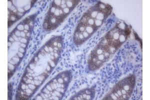 Image no. 2 for anti-Cadherin 1, Type 1, E-Cadherin (Epithelial) (CDH1) antibody (ABIN1497942) (E-cadherin antibody)