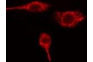 ABIN6275674 staining HuvEc cells by IF/ICC. (VTI1B antibody  (Internal Region))