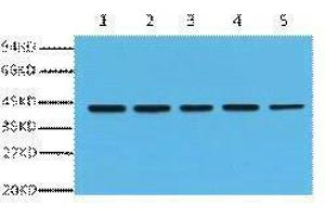 Western Blotting (WB) image for anti-Actin, beta (ACTB) antibody (ABIN3181101) (beta Actin antibody)