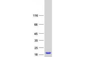 Western Blotting (WB) image for Retinol Binding Protein 5, Cellular (RBP5) protein (Myc-DYKDDDDK Tag) (ABIN2730762)