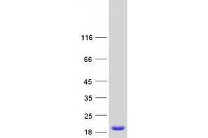 Validation with Western Blot (Retinol Binding Protein 5 Protein (Myc-DYKDDDDK Tag))