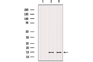 Western blot analysis of extracts from various samples, using SERF2 Antibody. (SERF2 antibody  (N-Term))