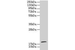 Western blot All lanes: TPPP2 antibody at 8 μg/mL + HepG2 whole cell lysate Secondary Goat polyclonal to rabbit IgG at 1/10000 dilution Predicted band size: 19 kDa Observed band size: 19 kDa (TPPP2 antibody  (AA 1-170))