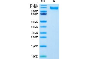 SARS-CoV-2 Spike S1 (Delta B. (SARS-CoV-2 Spike S1 Protein (B.1.617.2 - delta) (His tag))