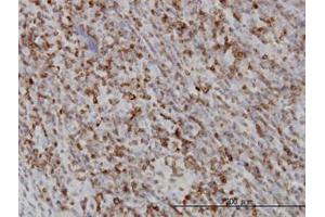 Image no. 2 for anti-RAB27A, Member RAS Oncogene Family (RAB27A) (AA 122-222) antibody (ABIN598569) (RAB27A antibody  (AA 122-222))