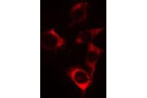 ABIN6269192 staining Hela cells by IF/ICC. (CBL antibody  (Internal Region))