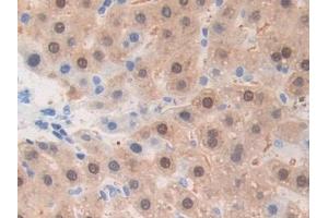 DAB staining on IHC-P; Samples: Rat Liver Tissue (ADAM1 antibody  (AA 463-727))