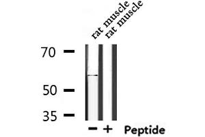 Western blot analysis of extracts from rat muscle, using TIGD4 Antibody. (TIGD4 antibody  (Internal Region))