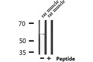 Western blot analysis of extracts from rat muscle, using TIGD4 Antibody.