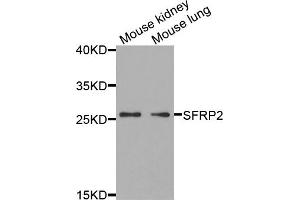 Western blot analysis of extracts of various cell lines, using SFRP2 antibody (ABIN5973117) at 1/1000 dilution. (SFRP2 antibody)