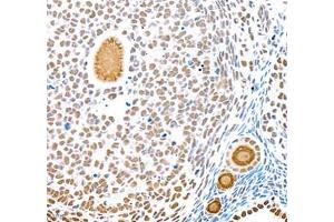 Immunohistochemistry (Paraffin-embedded Sections) (IHC (p)) image for anti-Topoisomerase (DNA) II alpha 170kDa (TOP2A) antibody (ABIN7075937)