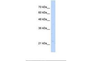 NUDT16L1 antibody  (AA 141-190)
