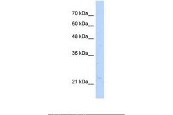 NUDT16L1 antibody  (AA 141-190)
