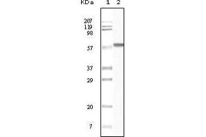 Western blot analysis using CK1 mouse mAb against truncated CK1 recombinant protein. (CSNK1A1 antibody)