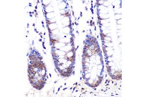 Immunohistochemistry of paraffin-embedded human colon using LXRα Rabbit mAb (ABIN1679005, ABIN3018365, ABIN3018366 and ABIN7101602) at dilution of 1:100 (40x lens).