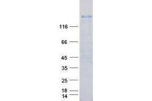 Bioactivity measured with Activity Assay (ERBB3 Protein (Transcript Variant 1) (Myc-DYKDDDDK Tag))