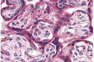 Placenta, Human: Formalin-Fixed, Paraffin-Embedded (FFPE) (EPHX2 antibody  (C-Term))