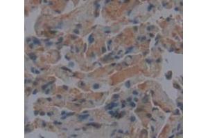 IHC-P analysis of Human Tissue, with DAB staining. (CGRP antibody  (AA 1-127))