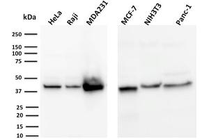 Western Blot Analysis of HeLa, Raji, MDA231, MCF-7, NIH3T3, Panc-1, cell lysates using PD-L2 Mouse Monoclonal Antibody (PDL1/2744).