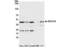 Western Blotting (WB) image for anti-Succinate-CoA Ligase, GDP-Forming, beta Subunit (SUCLG2) (AA 25-75) antibody (ABIN7449835)