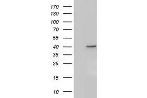 HEK293T cells were transfected with the pCMV6-ENTRY control (Left lane) or pCMV6-ENTRY ACAT2 (Right lane) cDNA for 48 hrs and lysed. (ACAT2 antibody)