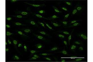 Immunofluorescence of monoclonal antibody to OXSR1 on HeLa cell. (OXSR1 antibody  (AA 351-450))