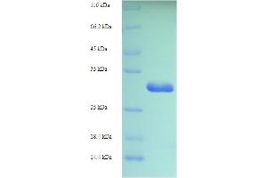 SDS-PAGE (SDS) image for Ionized Calcium-binding Adapter Molecule 1 (IBA1) (AA 2-147) protein (His-SUMO Tag) (ABIN5709023) (Iba1 Protein (AA 2-147) (His-SUMO Tag))