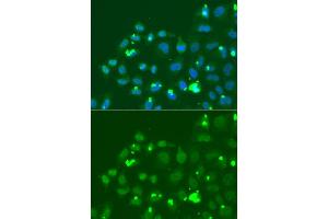Immunofluorescence analysis of A549 cell using ATF3 antibody. (ATF3 antibody)