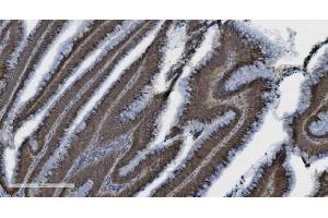 IHC analysis of PARP using anti-PARP antibody (ABIN7602277).