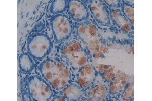 Used in DAB staining on fromalin fixed paraffin- embedded intestine tissue (Phospholipase C beta 2 antibody  (AA 1-250))