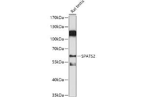 Western blot analysis of extracts of Rat testis, using SP antibody (ABIN7270526) at 1:1000 dilution. (SPATS2 antibody  (AA 1-240))