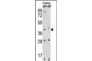 Western blot analysis of HYAL2 Antibody Pab pre-incubated without(lane 1) and with(lane 2) blocking peptide in Hela cell line lysate.