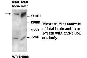 Image no. 1 for anti-Son of Sevenless Homolog 1 (SOS1) antibody (ABIN791240) (SOS1 antibody)