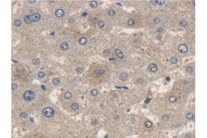 Detection of ME2 in Human Liver Tissue using Polyclonal Antibody to Malic Enzyme 2, NADP+ Dependent, Mitochondrial (ME2) (Malic Enzyme 2, NADP+ Dependent, Mitochondrial (AA 220-426) antibody)