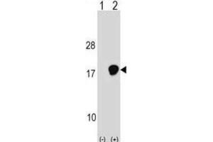 Western Blotting (WB) image for anti-Ubiquitin-Conjugating Enzyme E2D 3 (UBE2D3) antibody (ABIN2999003) (UBE2D3 antibody)