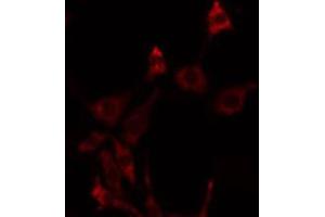 ABIN6275765 staining NIH-3T3 by IF/ICC. (FGFRL1 antibody  (Internal Region))