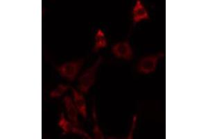 ABIN6275765 staining NIH-3T3 by IF/ICC. (FGFRL1 antibody  (Internal Region))