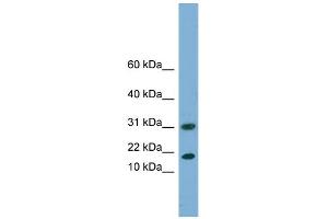 WB Suggested Anti-EIF5A2 Antibody Titration: 0.