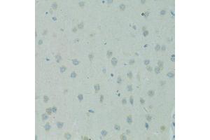 Immunohistochemistry of paraffin-embedded rat brain using SMAD6 antibody. (SMAD6 antibody)