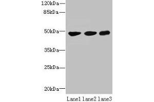 Western blot All lanes: UXS1 antibody at 6 μg/mL Lane 1: Mouse lung tissue Lane 2: Jurkat whole cell lysate Lane 3: HepG2 whole cell lysate Secondary Goat polyclonal to rabbit IgG at 1/10000 dilution Predicted band size: 48, 49, 29 kDa Observed band size: 48 kDa