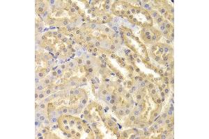 Immunohistochemistry of paraffin-embedded Mouse kidney using CDK9 antibody at dilution of 1:100 (x400 lens). (CDK9 antibody  (AA 153-372))