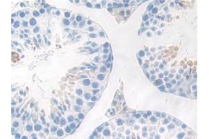 DAB staining on IHC-P; Samples: Mouse Testis Tissue (IKbIP antibody  (AA 78-301))