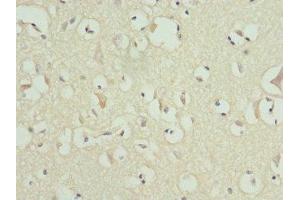 Immunohistochemistry of paraffin-embedded human brain tissue using ABIN7159178 at dilution of 1:100