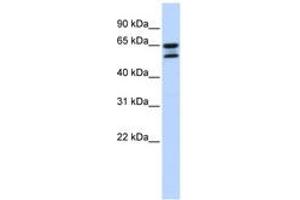 Image no. 1 for anti-Acyl-CoA Thioesterase 11 (ACOT11) (AA 504-553) antibody (ABIN6743818) (ACOT11 antibody  (AA 504-553))